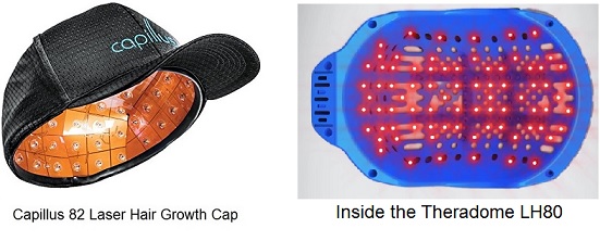 Capillus vs theradome laser inside cap