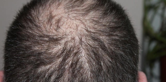 Laser Hair Growth Cap Tips Effective